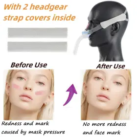 Befiy 714855883946 2 Pack Advanced Upgraded P10 Replacement Headgear Straps With Strap Covers
