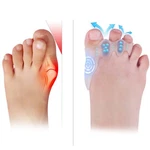 Tevezo Toe Spacers & Small-kids, Corrector Set (1 Pair, 20 Fillers) New. Price: $30.05.