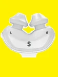Pcs Resmed Airfit P10 Small Nasal Pillow #62931 New. Price: $8.99.